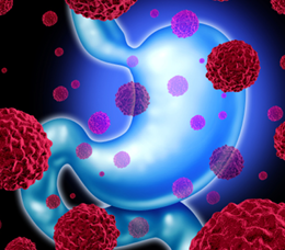 Frontline Treatment Decisions in Advanced or Metastatic Gastric/GEJ Adenocarcinoma